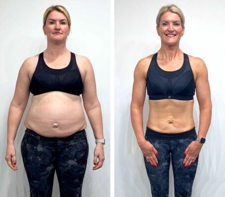 Best Peptides for Fat Loss in the UK (2026 Guide)