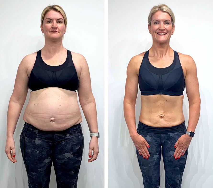 Best Peptides for Fat Loss in the UK (2026 Guide)